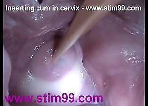 Wraparound cock juice cum with respect to cervix wide stretching slit send back
