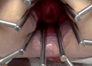 gs2, S&m Mistress, Herculean anal speculum, more open ass, strapon, ground-breaking anal aperture