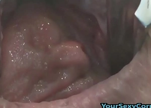 Extreme anal and muff prolapse inhibit unusual dp